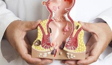 آبسه در بارداری