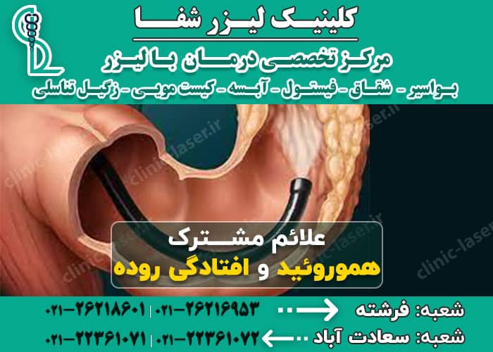 علائم مشترک هموروئید و افتادگی روده 