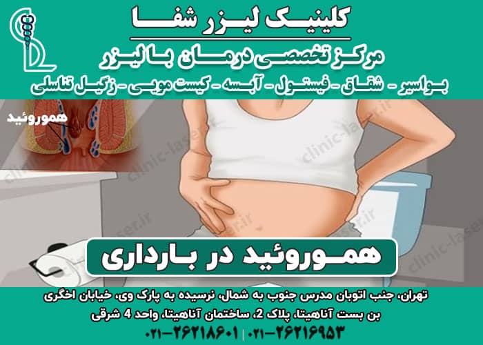 هموروئید در بارداری